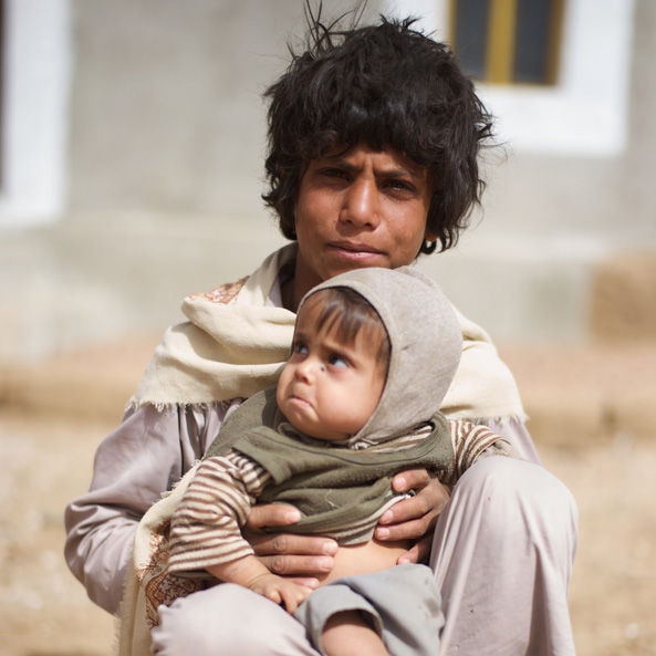 A young boy with his malnourished sibling in Kitaf in the far west of Sadah, Yemen. Photo: Julien Harneis/Unicef