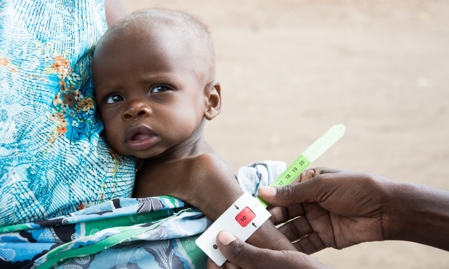 In Malawi, 7-month-old Regison’s arm measurement shows severe malnutrition. PLease donate and help Unicef reach more children affected by the food crisis.