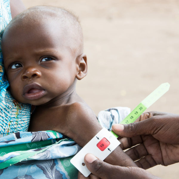 In Malawi, 7-month-old Regison’s arm measurement shows severe malnutrition. PLease donate and help Unicef reach more children affected by the food crisis.