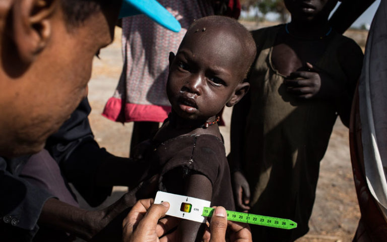 Unicef South Sudan nutrition specialist Kibrom measures a young boy's upper arm circumference to determine whether he is malnourished. Photo: Unicef / Siegfried Modola