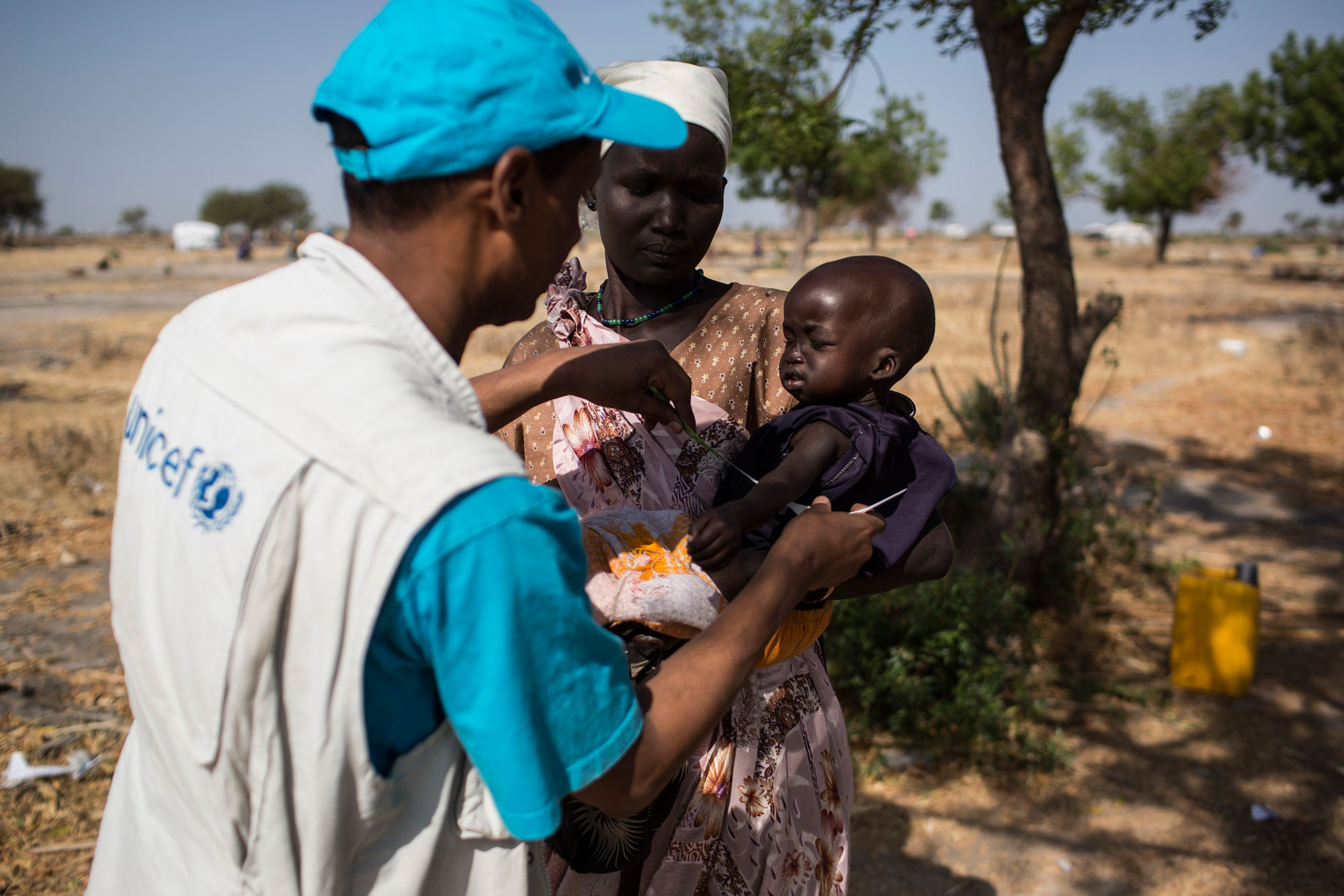 Unicef South Sudan nutrition specialist checks a young child for malnutrition during a rapid response mission to a remote area of South Sudan in East Africa. Photo: Siegfried Modola / Unicef