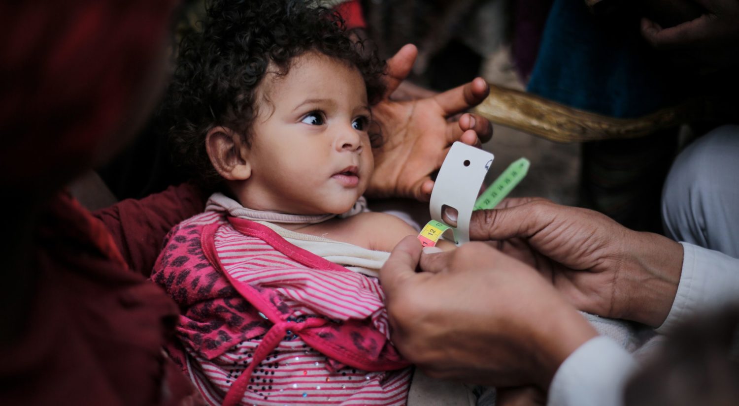 A young girl's arm is measured in Yemen to ensure that she is protected from malnutrition. Unicef/2017