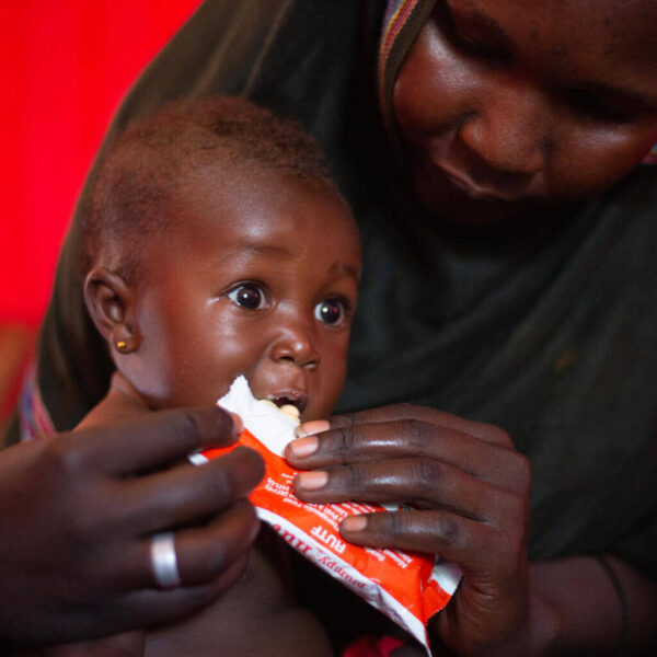 A child suffering from malnutrition nibbles on ready-to-use-therapeutic food provided during an integrated health campaign.