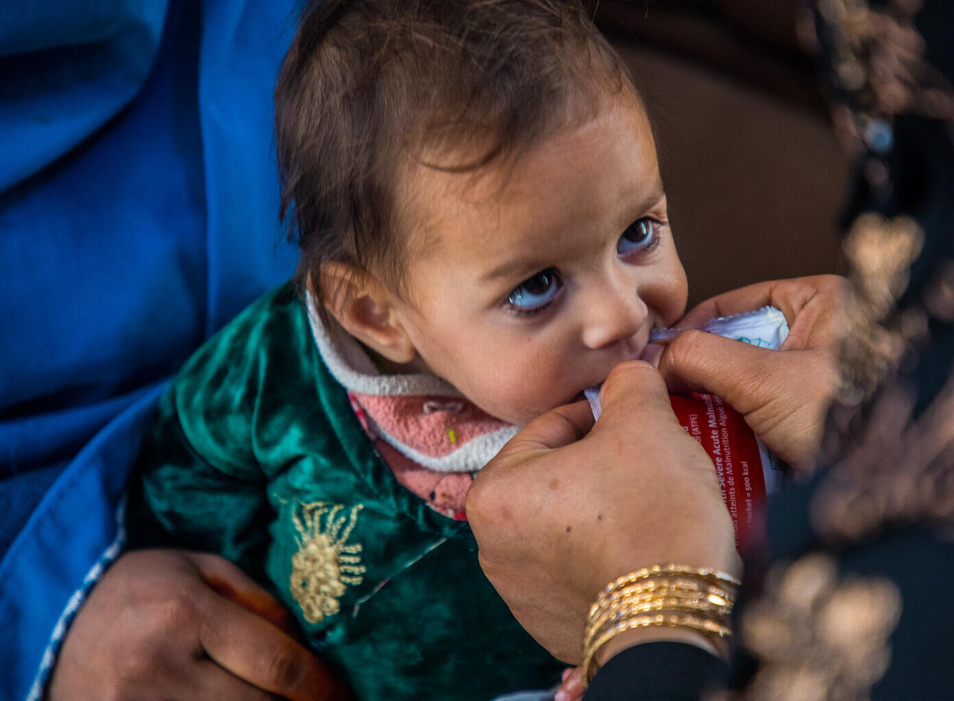 A very young child bites down on a packet of therapeutic food in a health centre in Afghanistan.
